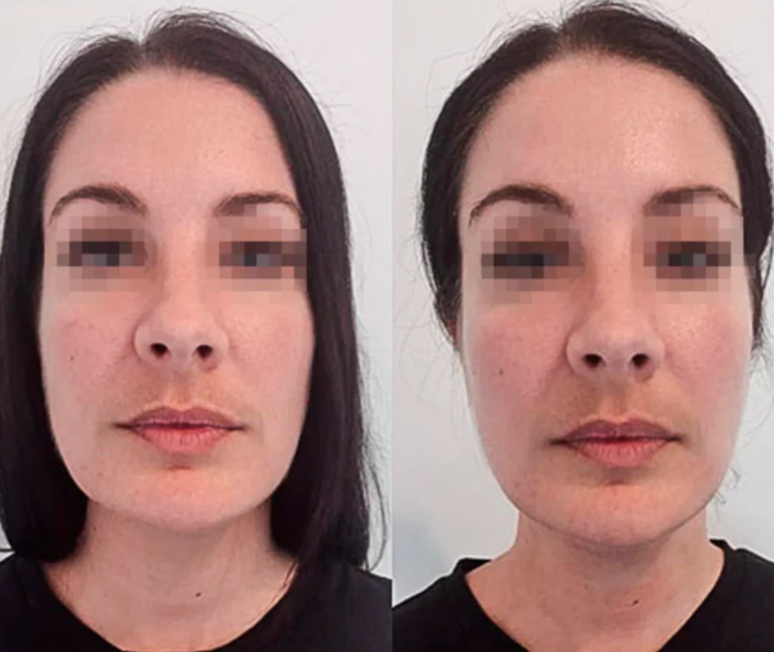 Liquid Lymphatic Drainage