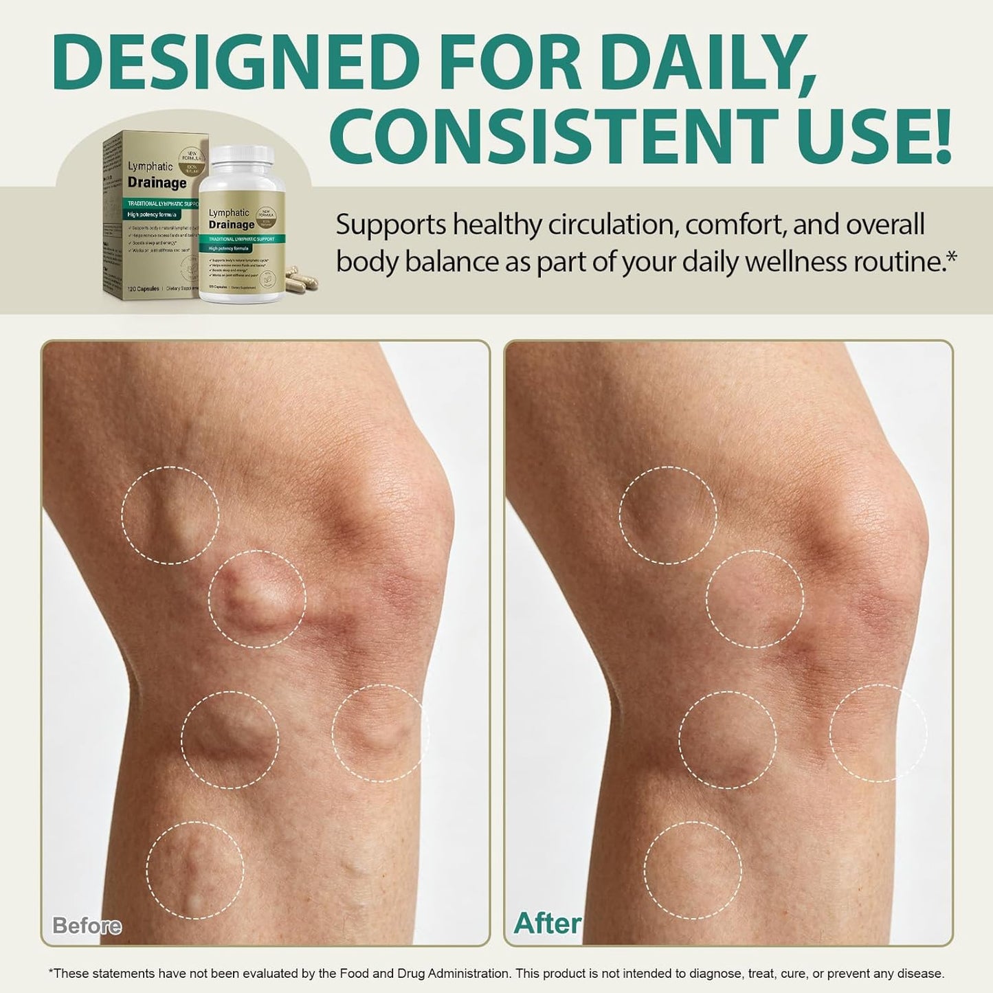 Lymphatic Drainage Capsules
