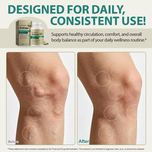 Lymphatic Drainage Capsules
